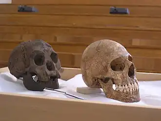 Comparação entre o crânio LB1 (à esquerda) e crânio de humano moderno com microcefalia.